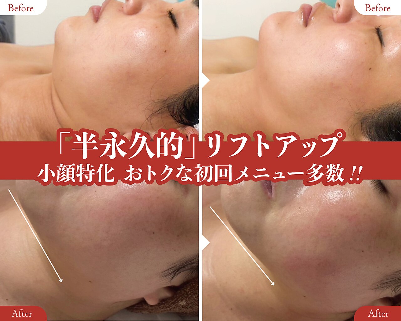カシェボーテ(CACHE BEAUTE)｜ホットペッパービューティー