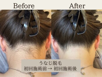 インベスト(INVEST)/うなじ☆