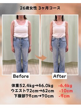 くさば整骨院/26歳女性/ダイエット3か月コース