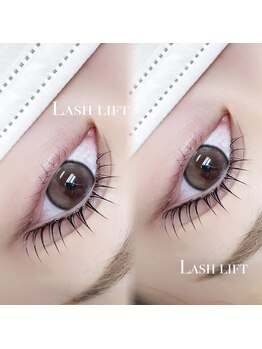 エメ(Eme.)の写真/【24時間まつ毛が可愛い！】目元のお悩み全て解消！バランスの取れた魅力的なお目元へ♪