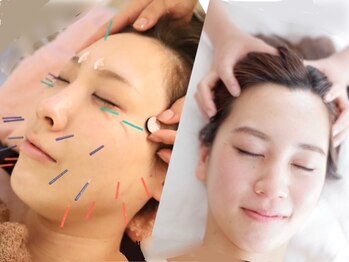 リリーフ(relief)の写真/ワンランク上の長持ちリフトup★中顔面短縮！ヘッドスパ+美容鍼SETでエラ張り改善&毛穴へ徹底アプローチ！