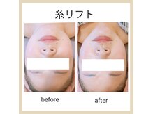 サロンドルポ(Salon de Repos)の雰囲気（最新たるみケア糸リフトフェイシャル導入開始しました！）