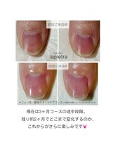 ネイルサロン ラピエトラ(la pietra)/最強のネイルケア３ケ月間コース