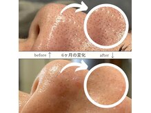 シト(Shito)の雰囲気（完全個室空間での施術です。）