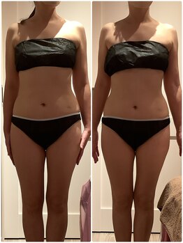 プリヴィエレジェ(privilegie)/