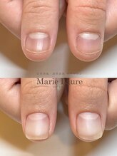マリーロール 梅田店(Marie Laure)/自爪育成/深爪矯正/ネイルケア