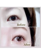 アンベリイルラッシュ(Embellir Lash)/上下まつげパーマラッシュリフト