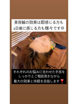 ノフ 恵比寿(noff)/美容鍼