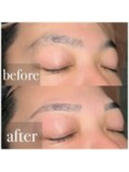 MDラボ 小松清六店/before after