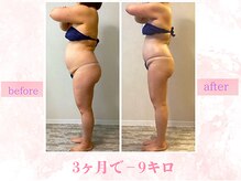 サロン ミオツクシ(SALON MIOTSUKUSHI)