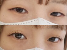 ウミカ(umica)/一重まぶたさんもお任せ下さい！