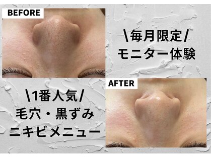 ミルトゥ(myrte)の写真