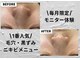 ミルトゥ(myrte)の写真