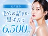 【毛穴詰まりに】 毛穴洗浄×お肌鎮静ケア ￥18,000→
