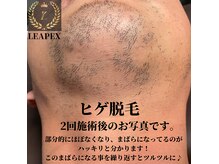 リーペックス(LEAPEX)の雰囲気（【メンズ脱毛】福井県内で1番効果にこだわっている脱毛サロン）