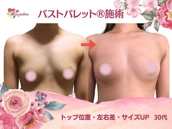 アンジェリークBB バストパレット本店