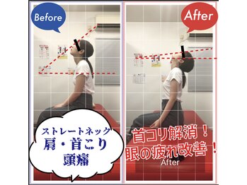 ナオル整体 武蔵小杉院(NAORU整体)/頑固な首コリ、肩こりを解消！