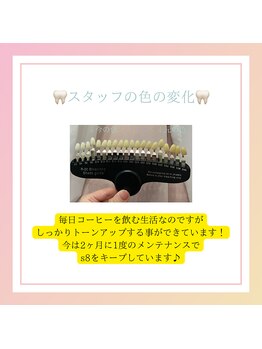 プラスビー 2号店(+b)/スタッフのホワイトニング
