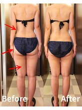 ヴィセル(VISEL)/トータルマイナス10cm 痩身