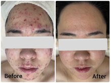 クリアプラス 小禄店(Clear+)/肌管理