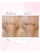 ソレラ(sorelle)/ピーリングワックス