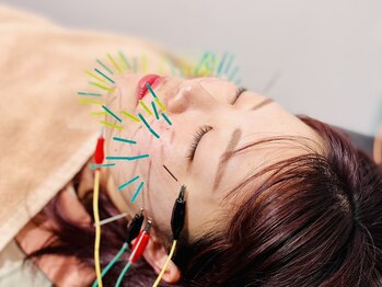桐生ひろさわ整骨院の写真/話題の美容鍼施術でシワやたるみ、肌トラブル改善◎丁寧な施術をリラックスした空間で受けていただけます♪