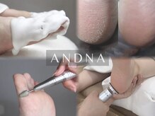 アンドナ バイ ケディット(ANDNA by KEDIT)の雰囲気（超本格的な角質ケアを仙台初導入！マシン使用で驚きのツルふわに）