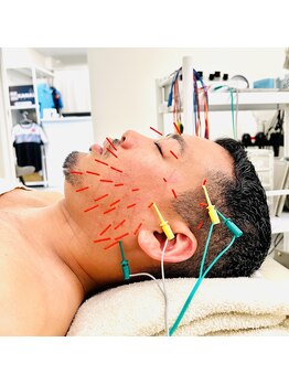 銀座鍼処 カナウ(KANAU)/メンズ美容鍼もやってます♪