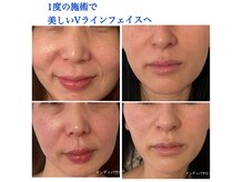 ソラ(sola)の雰囲気（お顔のコリ浮腫みをとり、そのかた本来の美しさを引き出します）