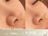 毛穴洗浄＆美容液導入【プラズマ】皮脂をごっそり除去◆パック付き￥9,990