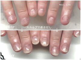 深爪の方のスカルプ