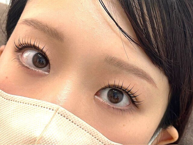 小顔効果抜群！上下ラッシュリフト