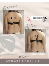 リンガ(Ringa)/ビフォーアフター【腸活ケア】