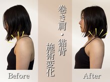 ウィーブ(WIIVE)/巻き肩・猫背の変化