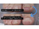 1回の矯正で変化を実感!