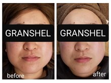 グランシェル(GRANSHEL)/