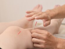 令和さくら鍼灸院 整体院/膝の鍼