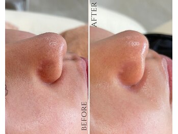 ザ ヴォーグ(the VOGUE)/どんな肌悩みがありますか？