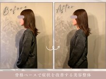 ほぐし屋 かすがい/猫背巻き肩矯正