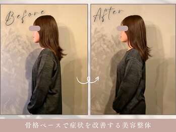 ほぐし屋 かすがい/猫背巻き肩矯正