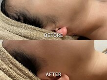 サロンドジェシカ(salon de Jessica)/デザイン顔脱毛