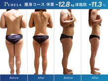 ピュアラ グランピュアラ難波店/全身マシン痩身エンダモロジー