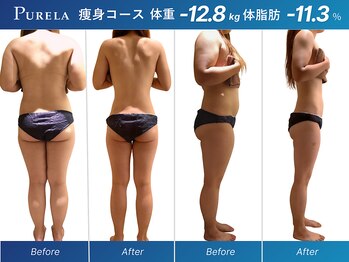 ピュアラ グランピュアラ難波店/全身マシン痩身エンダモロジー