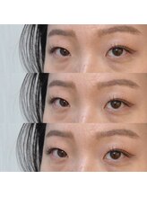 シアミス(SIAMIHS)/シングルエクステ