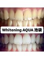 アクア 池袋店(AQUA) ホワイトニング/池袋/美白/ホワイトニング/ブライダル/東京
