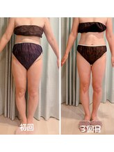 ヨサパーク オリ(YOSA PARK oli)/結果を早く出したい方は♪