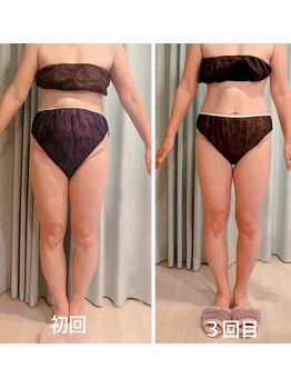 ヨサパーク オリ(YOSA PARK oli)/結果を早く出したい方は♪