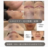 リモアボーテ(RIMOA beaute)