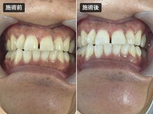 シャイン 久留米店(SHINE)の雰囲気（1回でこの変化◎脱毛も眉もホワイトニングもまとめてケア）