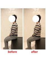 ナオル整体 福岡香椎院(NAORU整体)/40代女性施術事例【肩こり猫背】